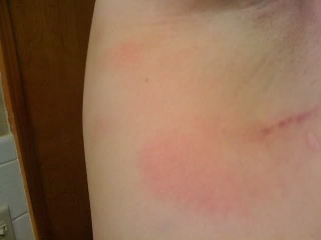red spots
